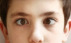 Στραβισμός